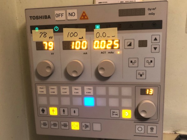 X線一般撮影装置